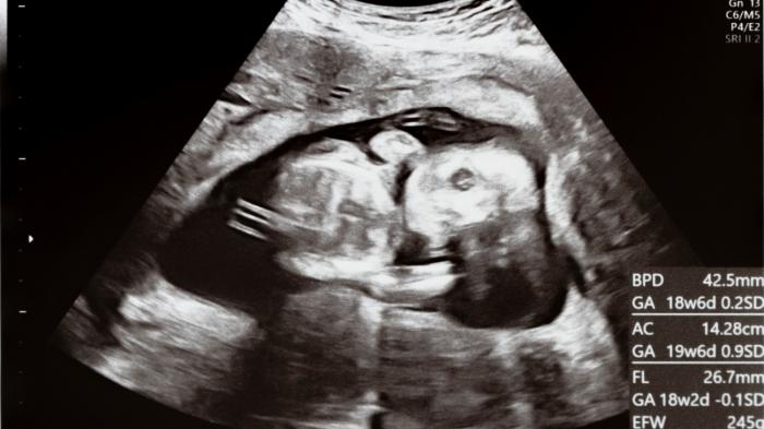 エコー写真の保存方法